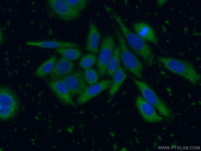 SRD5A1 Antibody in Immunocytochemistry (ICC/IF)