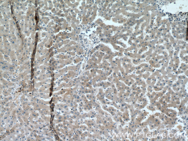 SRD5A1 Antibody in Immunohistochemistry (Paraffin) (IHC (P))