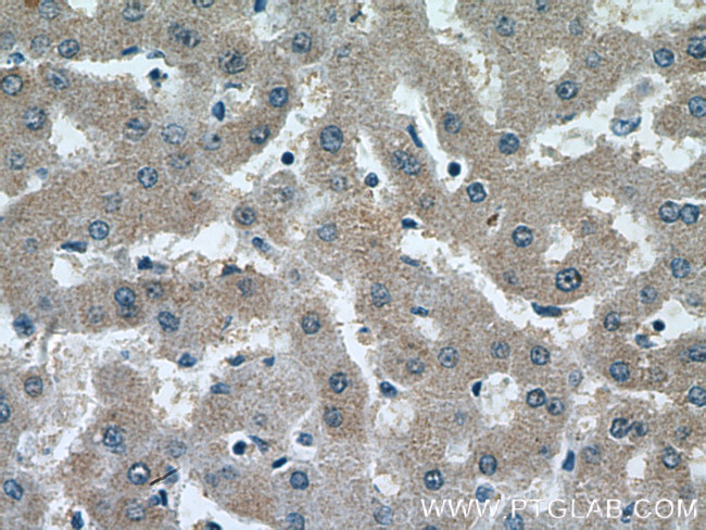 SRD5A1 Antibody in Immunohistochemistry (Paraffin) (IHC (P))