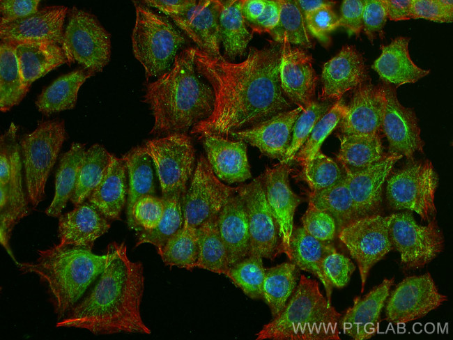 SMYD3 Antibody in Immunocytochemistry (ICC/IF)