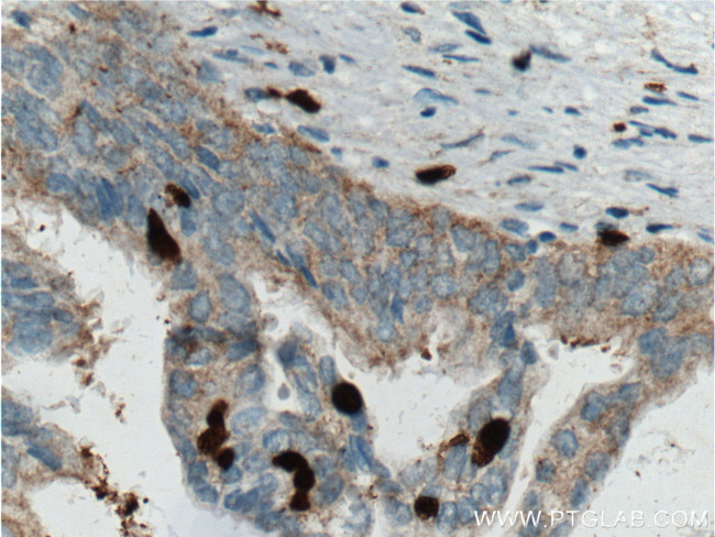 SMYD3 Antibody in Immunohistochemistry (Paraffin) (IHC (P))