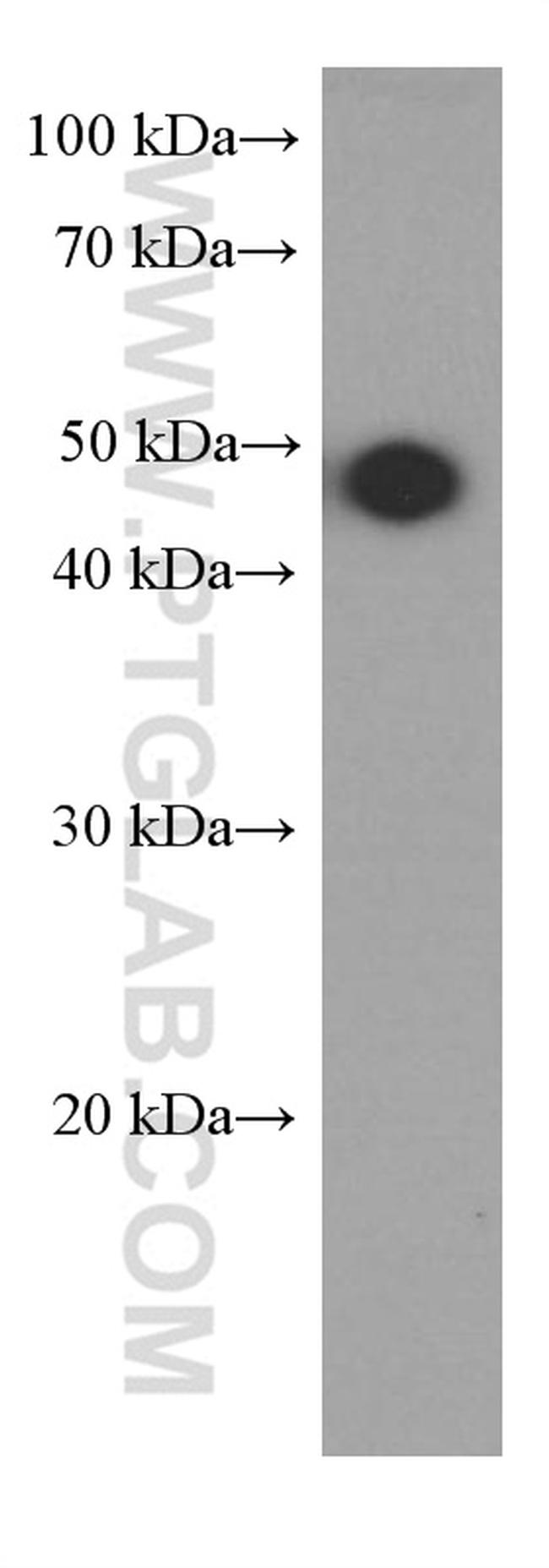 SMYD3 Antibody in Western Blot (WB)