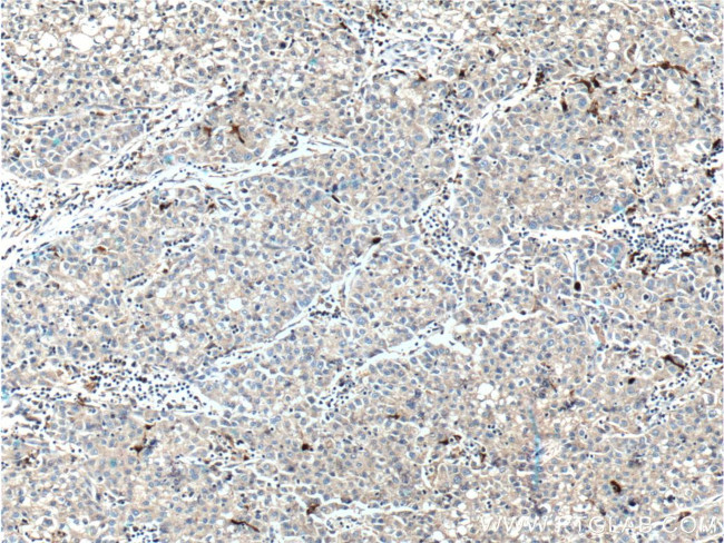 SMYD3 Antibody in Immunohistochemistry (Paraffin) (IHC (P))