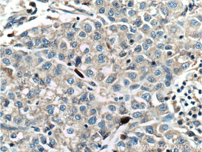 SMYD3 Antibody in Immunohistochemistry (Paraffin) (IHC (P))