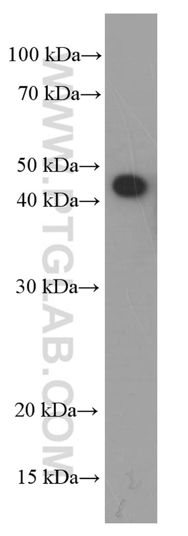 SMYD3 Antibody in Western Blot (WB)