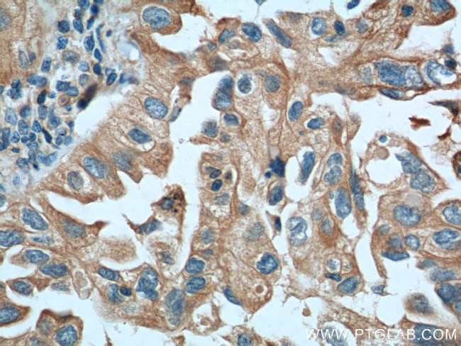 IGSF2 Antibody in Immunohistochemistry (Paraffin) (IHC (P))