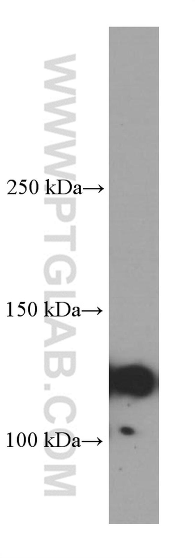 IGSF2 Antibody in Western Blot (WB)