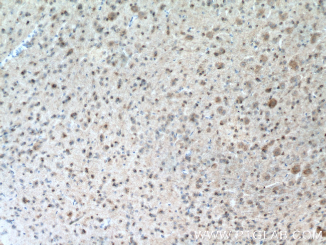 TH Antibody in Immunohistochemistry (Paraffin) (IHC (P))