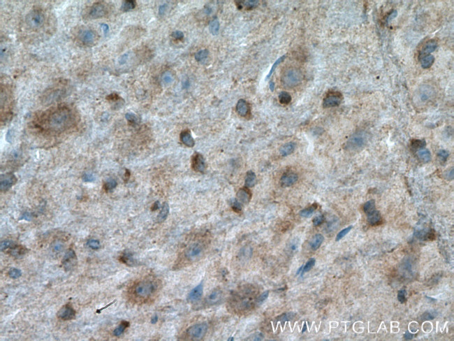 TH Antibody in Immunohistochemistry (Paraffin) (IHC (P))