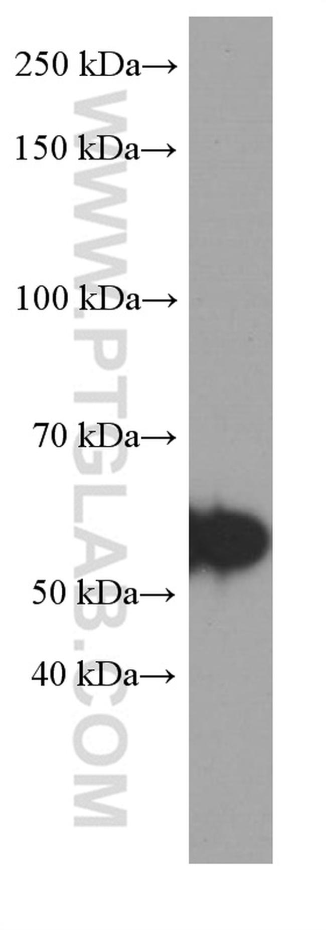 TH Antibody in Western Blot (WB)