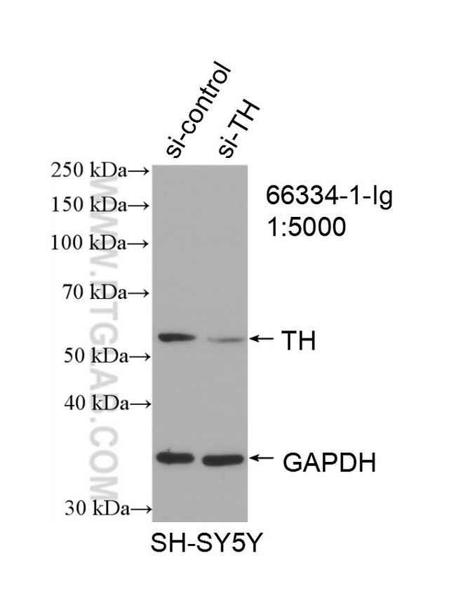 TH Antibody in Western Blot (WB)