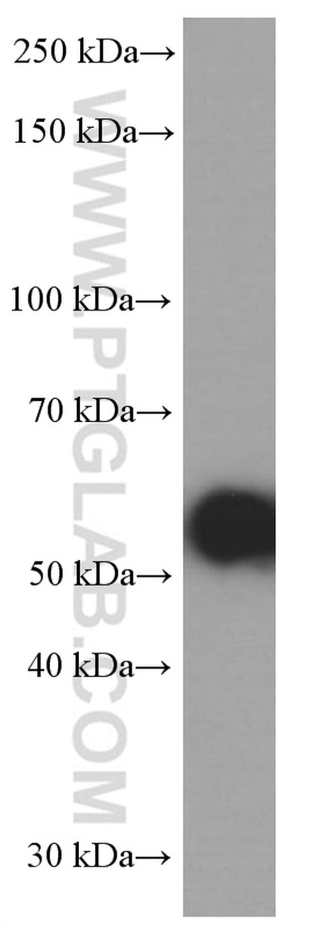 TH Antibody in Western Blot (WB)