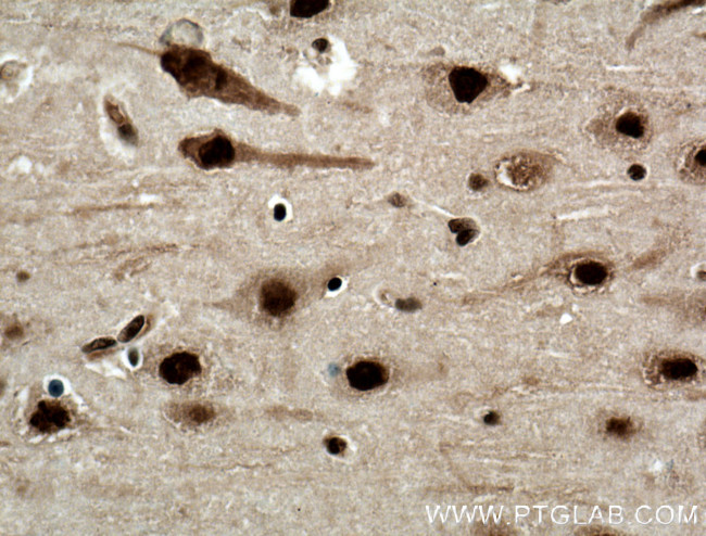 NUDT21 Antibody in Immunohistochemistry (Paraffin) (IHC (P))