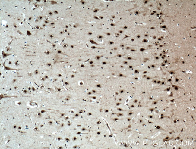 NUDT21 Antibody in Immunohistochemistry (Paraffin) (IHC (P))