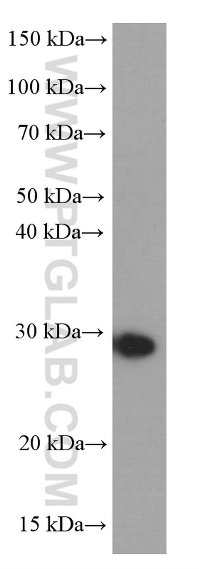 NUDT21 Antibody in Western Blot (WB)