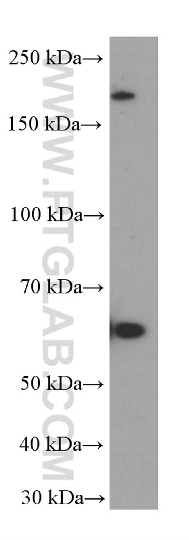 FOXN1 Antibody in Western Blot (WB)