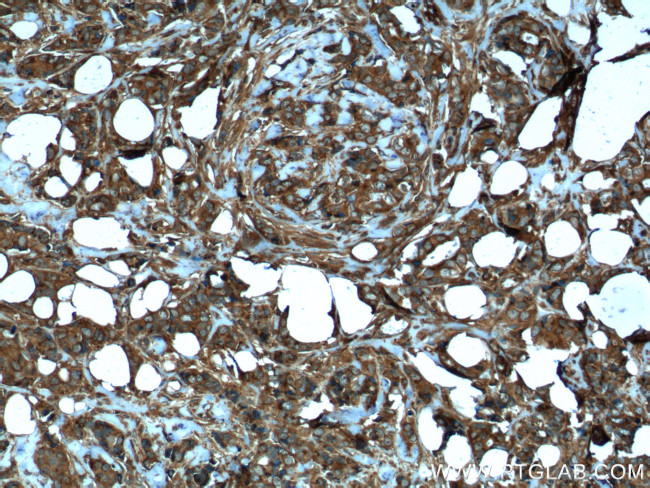 MMP3 Antibody in Immunohistochemistry (Paraffin) (IHC (P))