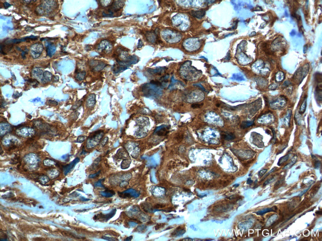 MMP3 Antibody in Immunohistochemistry (Paraffin) (IHC (P))