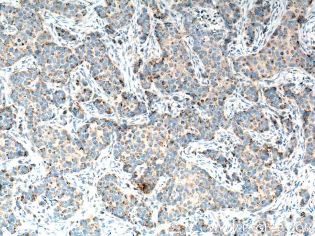 MMP3 Antibody in Immunohistochemistry (Paraffin) (IHC (P))