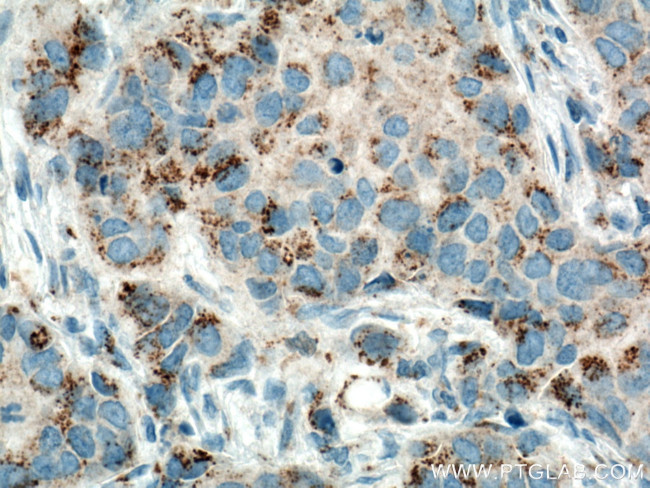 MMP3 Antibody in Immunohistochemistry (Paraffin) (IHC (P))