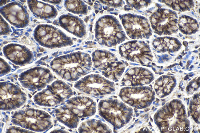 MMP3 Antibody in Immunohistochemistry (Paraffin) (IHC (P))