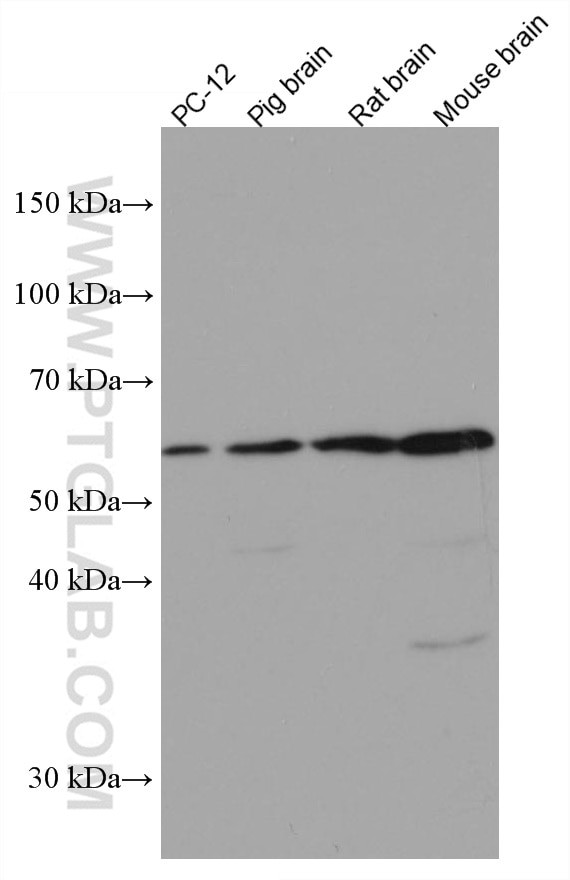 MMP3 Antibody in Western Blot (WB)