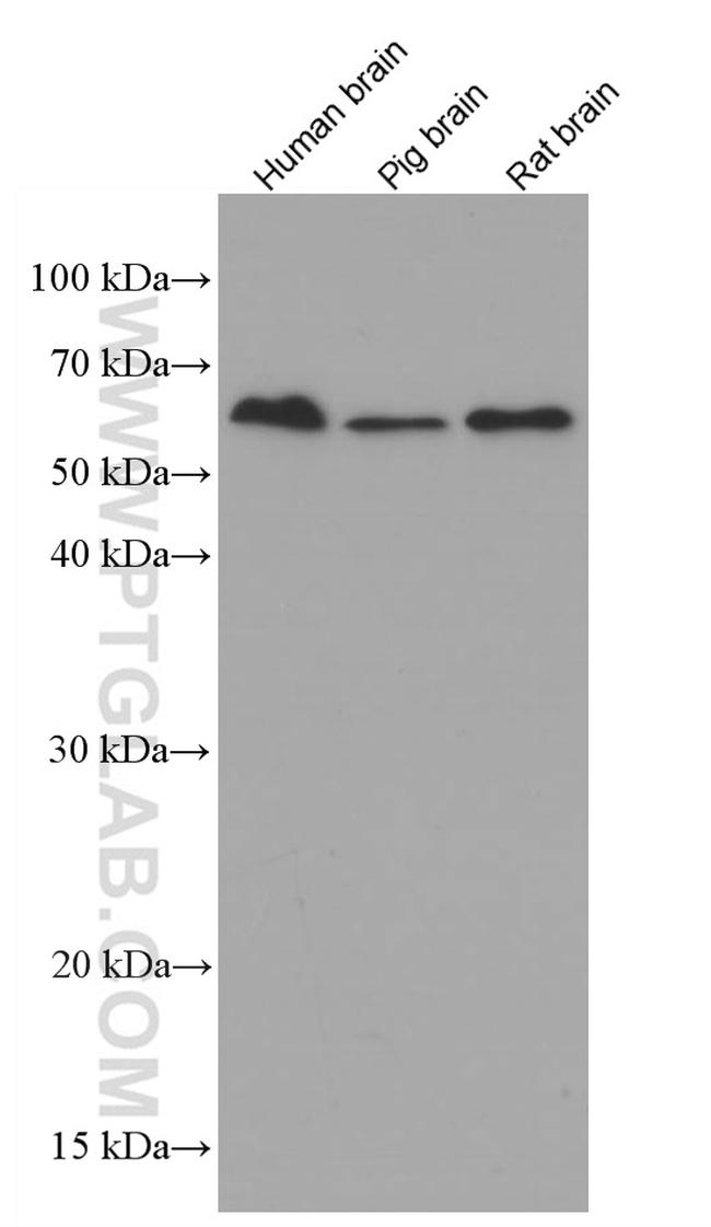 MMP3 Antibody in Western Blot (WB)