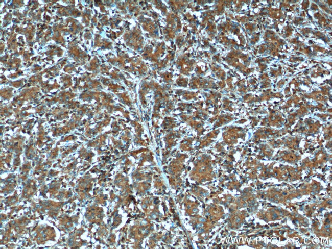 MMP3 Antibody in Immunohistochemistry (Paraffin) (IHC (P))