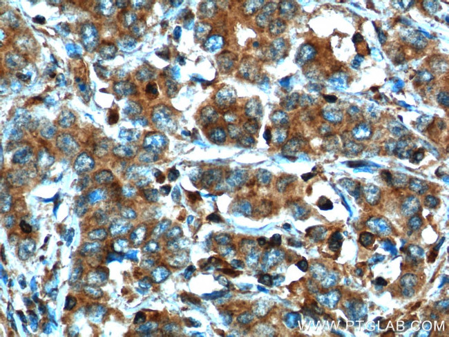 MMP3 Antibody in Immunohistochemistry (Paraffin) (IHC (P))