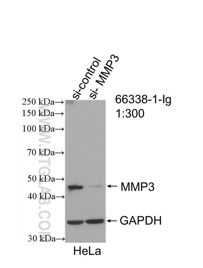 MMP3 Antibody in Western Blot (WB)