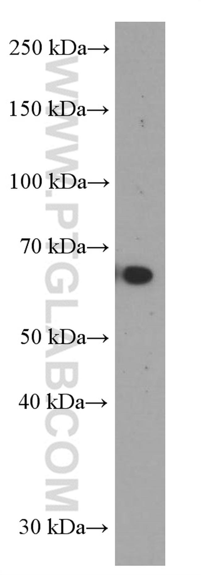 MMP3 Antibody in Western Blot (WB)