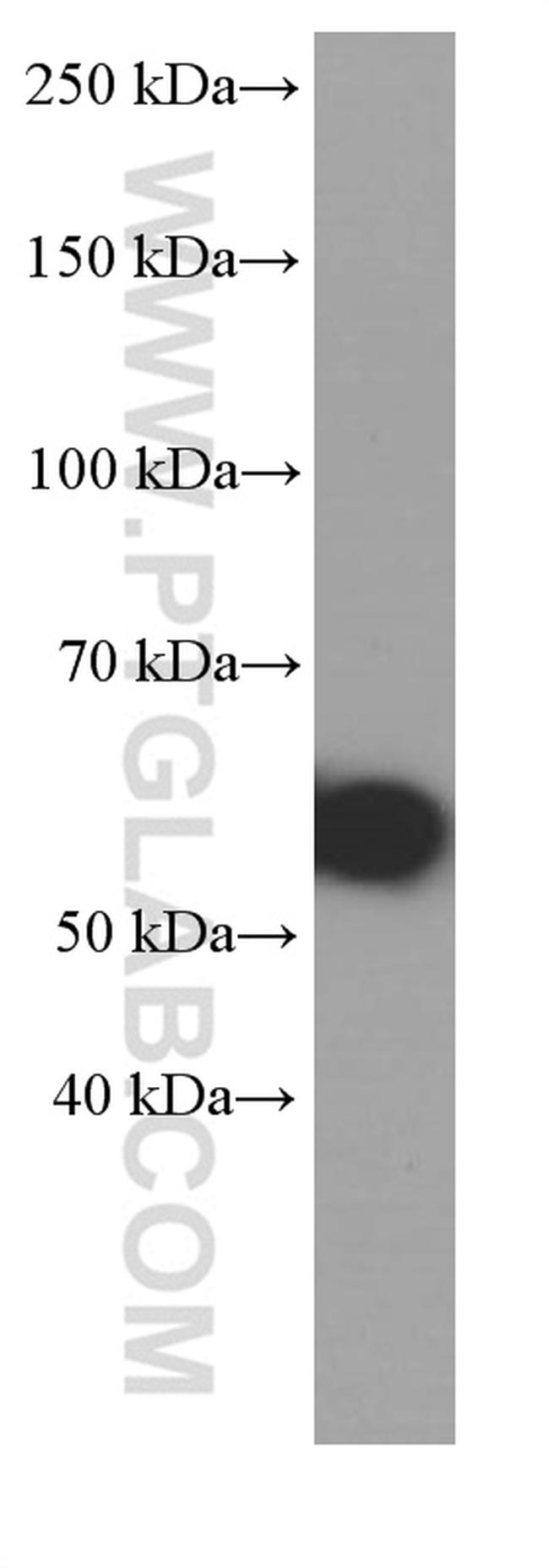 MMP3 Antibody in Western Blot (WB)