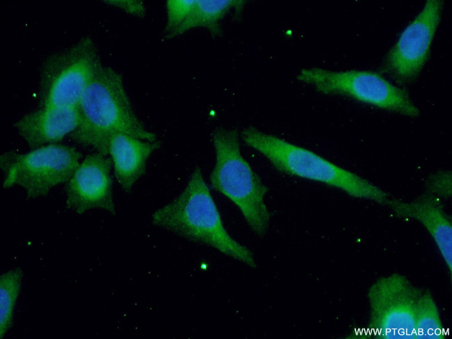 RAB5A Antibody in Immunocytochemistry (ICC/IF)