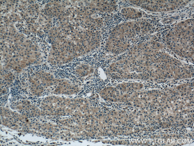 RAB5A Antibody in Immunohistochemistry (Paraffin) (IHC (P))