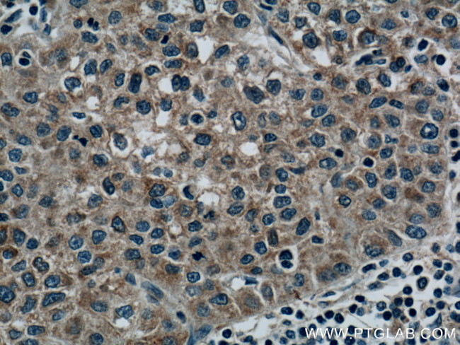 RAB5A Antibody in Immunohistochemistry (Paraffin) (IHC (P))