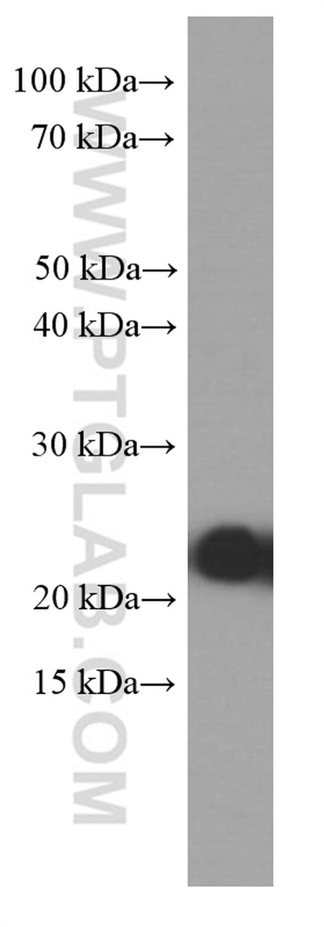 RAB5A Antibody in Western Blot (WB)