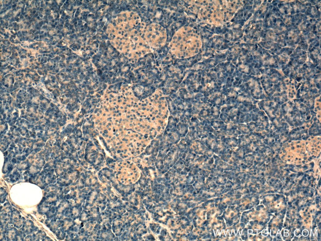 RAB5A Antibody in Immunohistochemistry (Paraffin) (IHC (P))