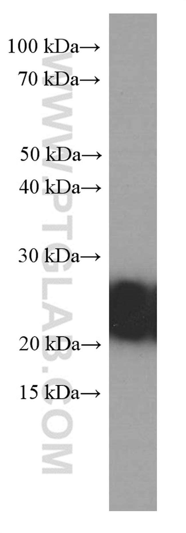 RAB5A Antibody in Western Blot (WB)