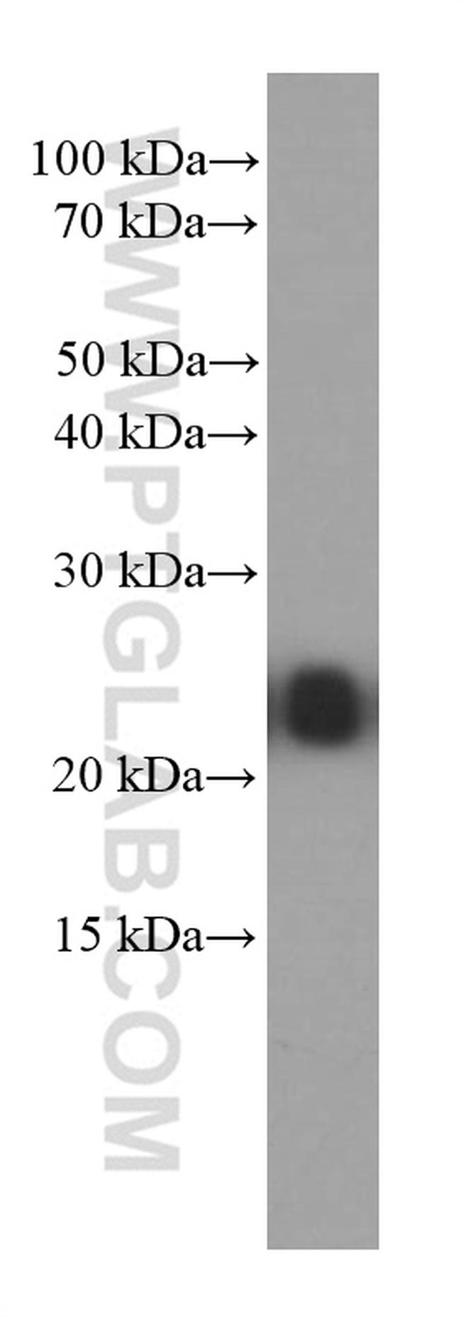 RAB5A Antibody in Western Blot (WB)