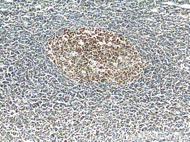 BCL6 Antibody in Immunohistochemistry (Paraffin) (IHC (P))