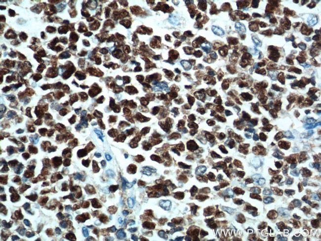 BCL6 Antibody in Immunohistochemistry (Paraffin) (IHC (P))