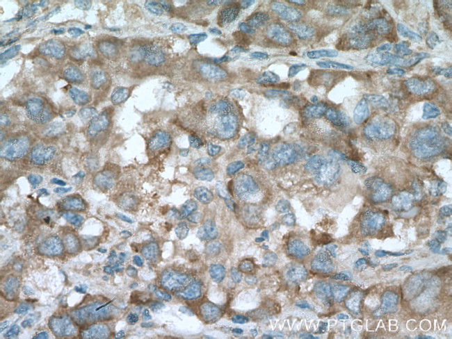 PLOD2 Antibody in Immunohistochemistry (Paraffin) (IHC (P))