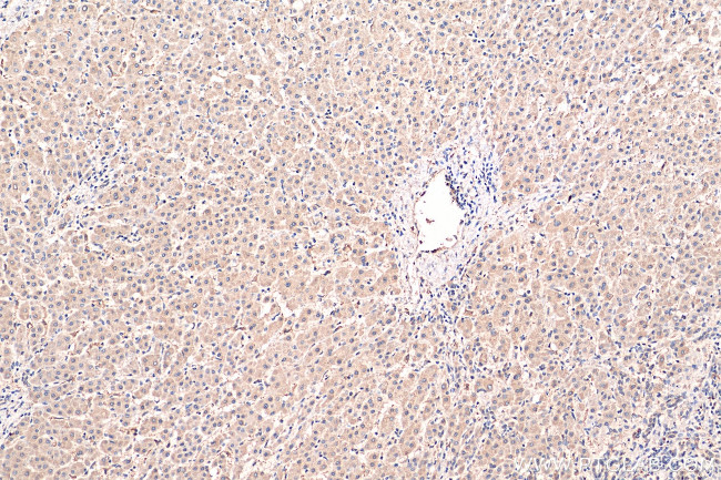 PLOD2 Antibody in Immunohistochemistry (Paraffin) (IHC (P))