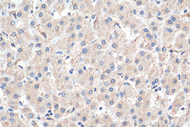 PLOD2 Antibody in Immunohistochemistry (Paraffin) (IHC (P))