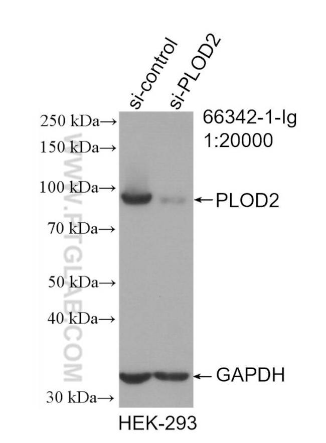 PLOD2 Antibody in Western Blot (WB)