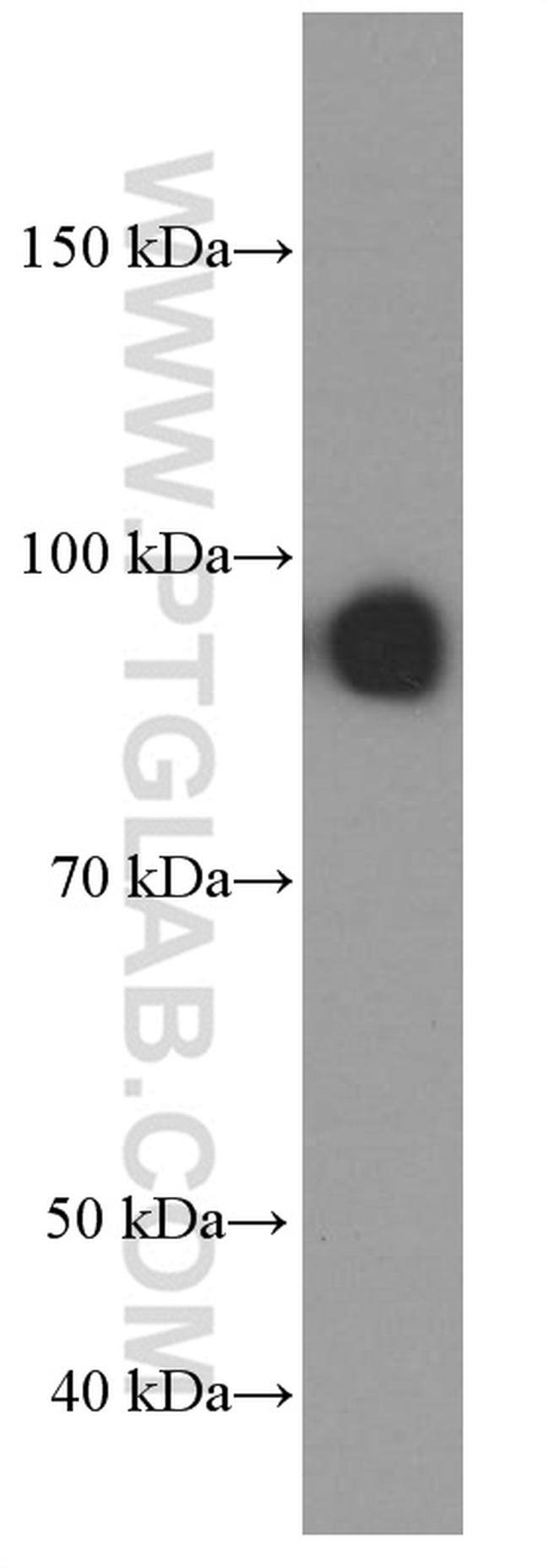 PLOD2 Antibody in Western Blot (WB)