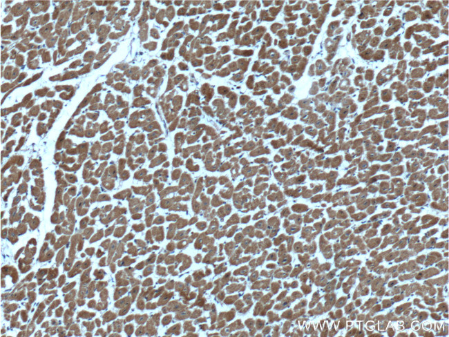 CLIC4 Antibody in Immunohistochemistry (Paraffin) (IHC (P))