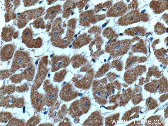 CLIC4 Antibody in Immunohistochemistry (Paraffin) (IHC (P))