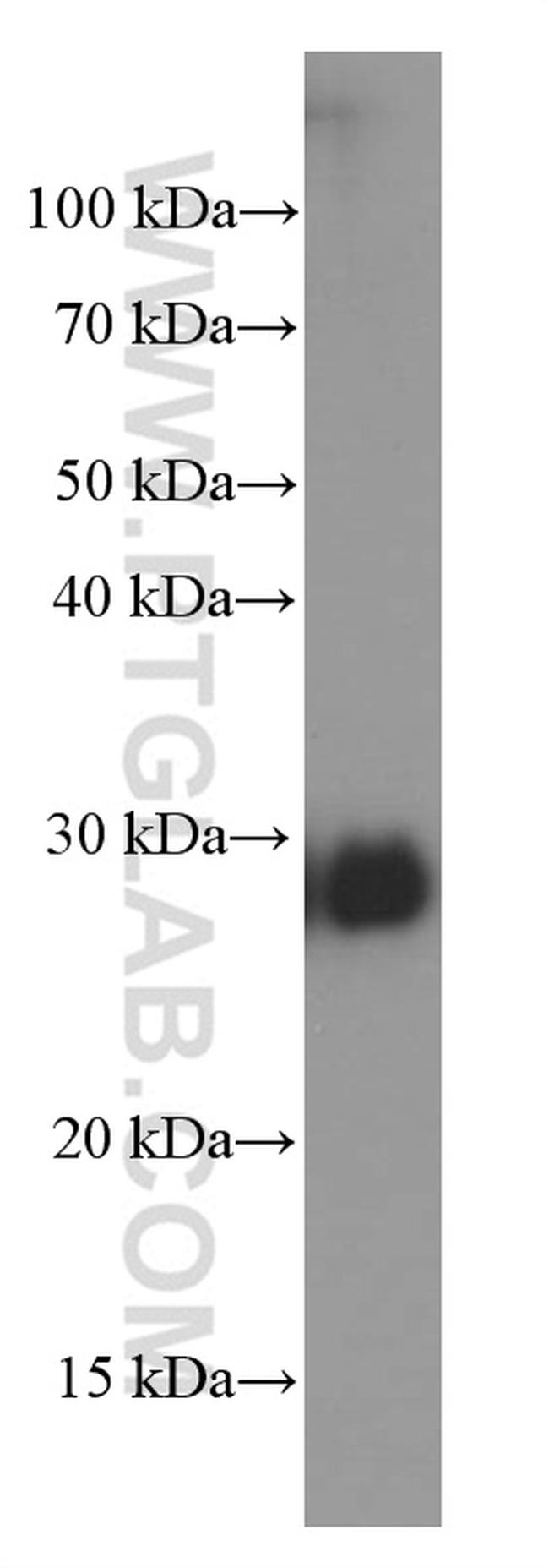 CLIC4 Antibody in Western Blot (WB)