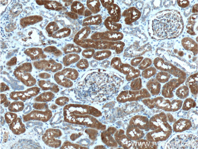 CLIC4 Antibody in Immunohistochemistry (Paraffin) (IHC (P))